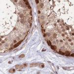 NSFL1C Antibody in Immunohistochemistry (IHC)