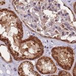 NSFL1C Antibody in Immunohistochemistry (IHC)