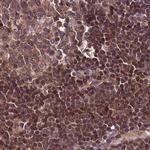 NSFL1C Antibody in Immunohistochemistry (IHC)