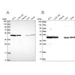 NSFL1C Antibody in Western Blot (WB)