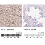 IGFBP-1 Antibody in Immunohistochemistry (IHC)