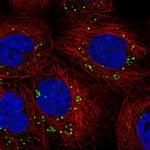 HMBS Antibody in Immunocytochemistry (ICC/IF)