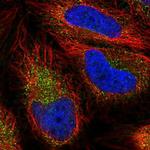 YLAT2 Antibody in Immunocytochemistry (ICC/IF)