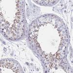 SCCPDH Antibody in Immunohistochemistry (IHC)