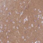 SLC8A2 Antibody in Immunohistochemistry (IHC)