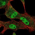 SLC25A45 Antibody in Immunocytochemistry (ICC/IF)