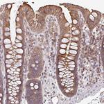 VENTX Antibody in Immunohistochemistry (IHC)