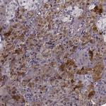 PNMT Antibody in Immunohistochemistry (IHC)