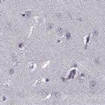 PNMT Antibody in Immunohistochemistry (IHC)