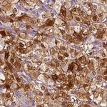 PNMT Antibody in Immunohistochemistry (IHC)