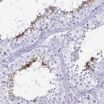 ACSBG2 Antibody in Immunohistochemistry (IHC)