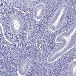 ACSBG2 Antibody in Immunohistochemistry (IHC)