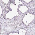 LMOD2 Antibody in Immunohistochemistry (IHC)