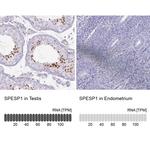 SPESP1 Antibody in Immunohistochemistry (IHC)