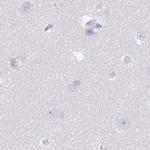 SPESP1 Antibody in Immunohistochemistry (IHC)