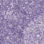 SPESP1 Antibody in Immunohistochemistry (IHC)