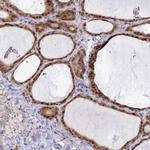 GINS1 Antibody in Immunohistochemistry (IHC)