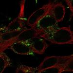 KCNT2 Antibody in Immunocytochemistry (ICC/IF)