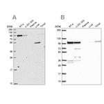 ZW10 Antibody in Western Blot (WB)