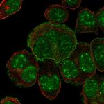 SLC34A1 Antibody in Immunocytochemistry (ICC/IF)