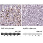 SLC26A9 Antibody