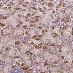 GPT2 Antibody in Immunohistochemistry (IHC)