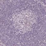 GPT2 Antibody in Immunohistochemistry (IHC)