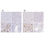 KCNE2 Antibody in Immunohistochemistry (IHC)