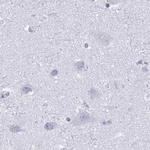 KCNE2 Antibody in Immunohistochemistry (IHC)