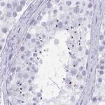 KCNE2 Antibody in Immunohistochemistry (IHC)