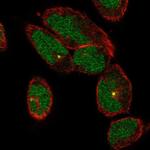 TTC30A Antibody in Immunocytochemistry (ICC/IF)