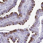 TTC30A Antibody in Immunohistochemistry (IHC)