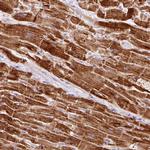 NDUFB4 Antibody in Immunohistochemistry (IHC)