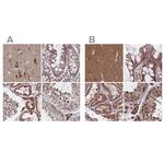 NFS1 Antibody in Immunohistochemistry (IHC)