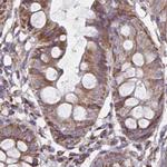 NFS1 Antibody in Immunohistochemistry (IHC)