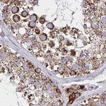 NFS1 Antibody in Immunohistochemistry (IHC)