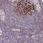 TMEM119 Antibody in Immunohistochemistry (IHC)