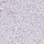 SLC7A8 Antibody in Immunohistochemistry (IHC)