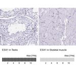 ESX1 Antibody in Immunohistochemistry (IHC)