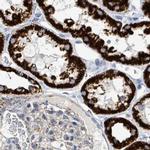 SUCLG2 Antibody in Immunohistochemistry (IHC)