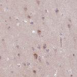 GEFT Antibody in Immunohistochemistry (IHC)