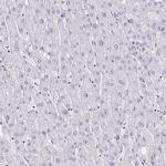 DAB1 Antibody in Immunohistochemistry (IHC)