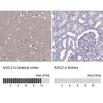 ASIC2 Antibody in Immunohistochemistry (IHC)