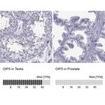 OIP5 Antibody in Immunohistochemistry (IHC)