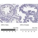 OIP5 Antibody