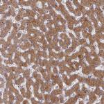 G6PC Antibody in Immunohistochemistry (IHC)