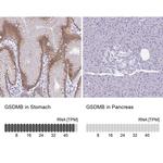 GSDMB Antibody in Immunohistochemistry (IHC)