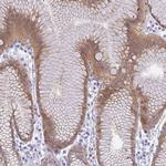 GSDMB Antibody in Immunohistochemistry (IHC)