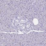 GSDMB Antibody in Immunohistochemistry (IHC)