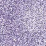 OGDHL Antibody in Immunohistochemistry (IHC)